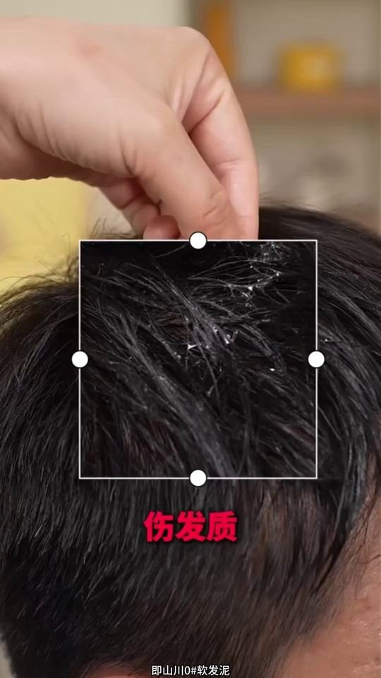 镜头19代表帧
